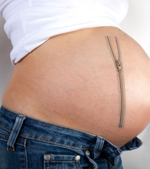 Растяжки во время беременности. Как избежать?