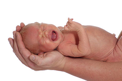 Пупочная грыжа и «щетинка» у новорожденного