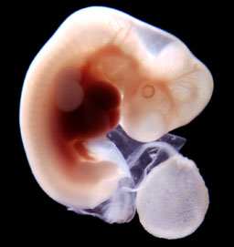 8 недель беременности вторая беременность. Эмбрион на 2 месяце беременности. Эмбрион 2 недели беременности фото плода.