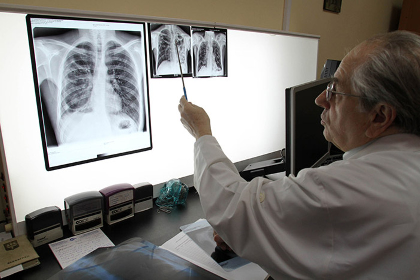 Сотрудник школы заразил учеников туберкулезом в Приморье